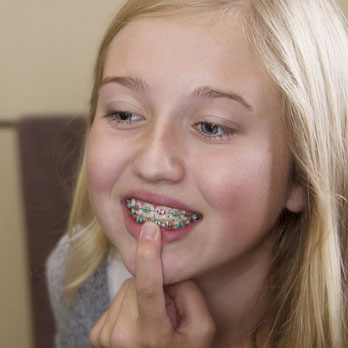 orthodontic rubber bands