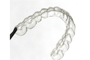 in-house clear aligners